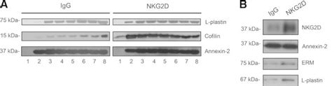 L Plastin Is Involved In Nkg D Recruitment Into Lipid Rafts And Nkg D