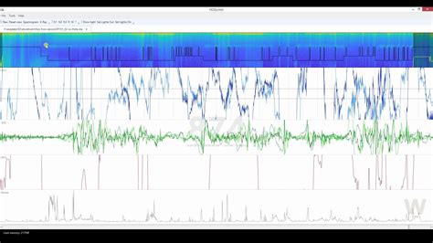 Fast Sleep Scoring With ZMax And HDScorer YouTube