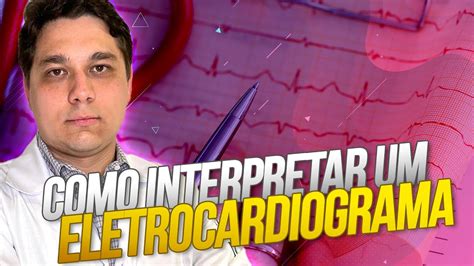 Como Interpretar Um Eletrocardiograma Youtube