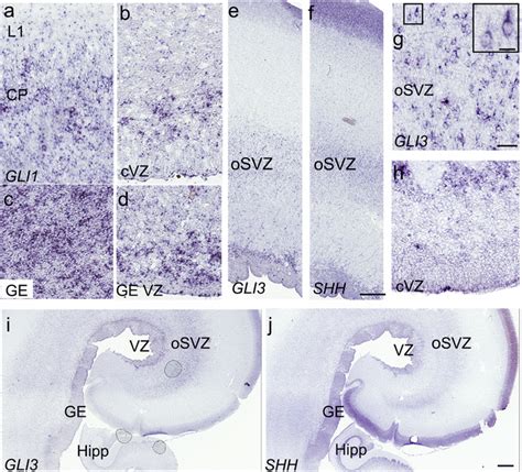 Components Of The Shh Signaling Pathway Are Expressed In The Human