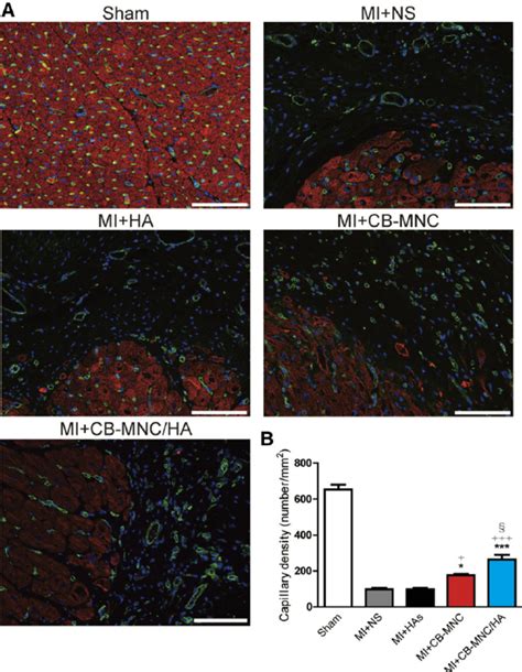 Injection Of Cb Mncha Increases Capillary Density At The Peri Infarct