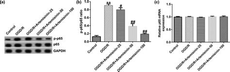 ART inhibits the activation of NF κB signaling pathway in OGD R induced