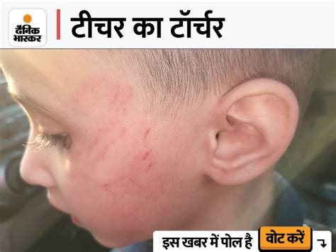 Four-year-old was beaten up in such a way that there were injury marks ...