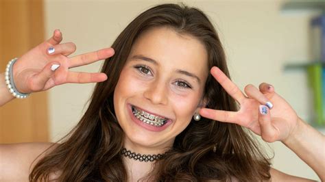 Understanding The Different Types Of Braces Adjustments