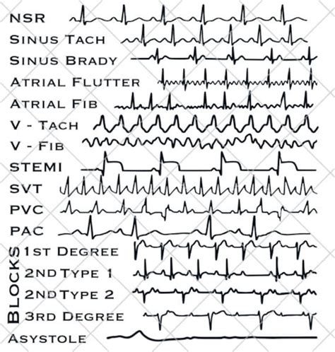 EKG Strips SVG Cardiac Monitor Nurse, Technician, Doctor Gift ...