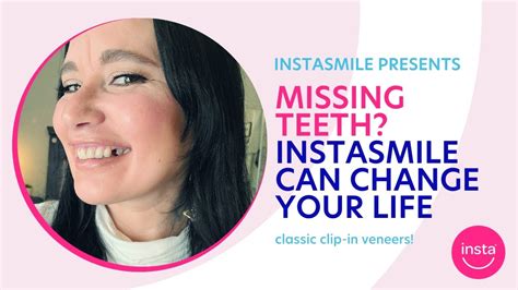 Getting Your Confidence Back With Instasmile Review Of Instasmile