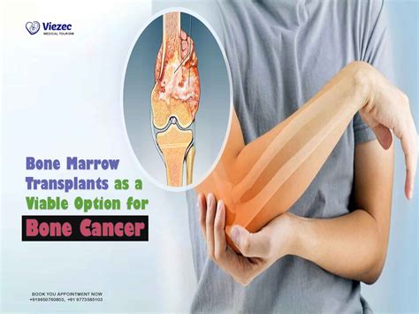 Causes Of Bone Marrow Cancer
