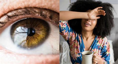 Scientist Explains What The Crusty Sleep In Your Eyes Actually Is