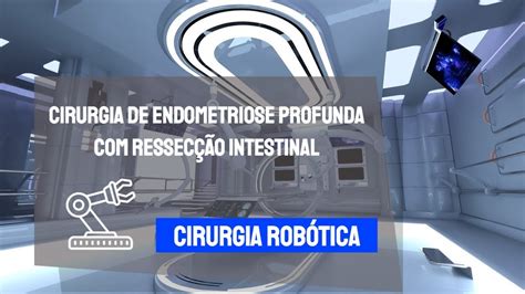 Cirurgia de endometriose profunda ressecção intestinal YouTube