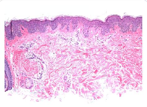 Epidermis Slide