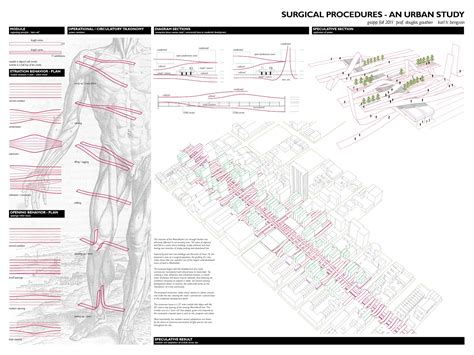 Surgical Procedures - Architizer