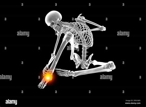 Ankle Pain Illustration Stock Photo Alamy