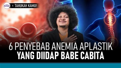 Mengenal Anemia Aplastik Penyakit Langka Yang Diidap Babe Cabita