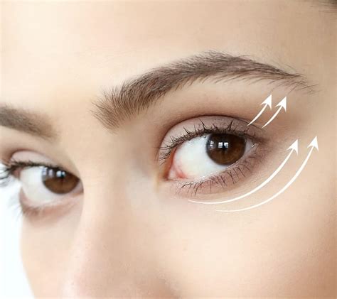 Rejuran I Treatment Eye Reviver Shens Medical Aesthetics