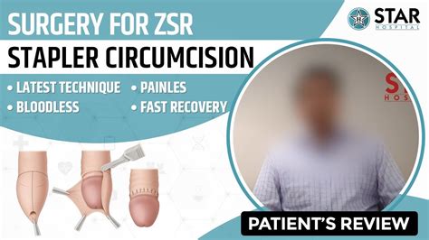 Stapler Circumcision ZSR Phagwara Punjab Best Hospital Bloodless