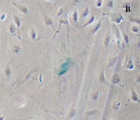 Sa Gal Staining Of Huvec Using Sa Gal On Fig A Huvec At