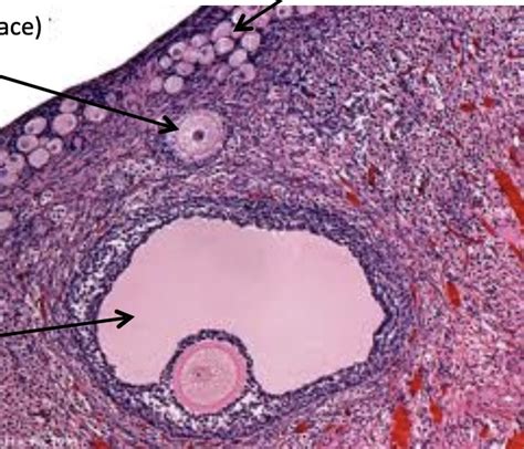 ovary histology Diagram | Quizlet