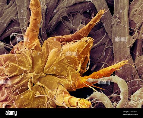 Dust mite. Coloured scanning electron micrograph (SEM) of the underside of a house dust mite ...