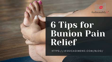 6 Tips for Bunion Pain Relief – Fashionably ill