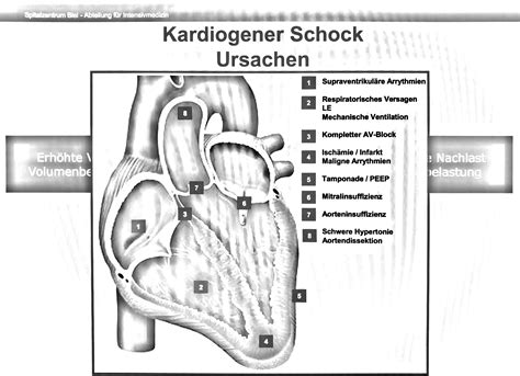 Schock Kardiogen Flashcards