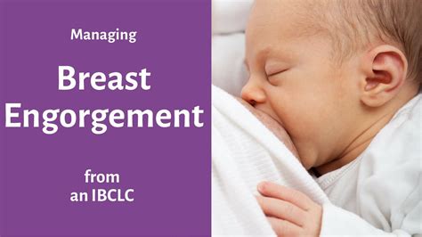 Breast Engorgement Postpartum Relief For Sore Breasts And Hard