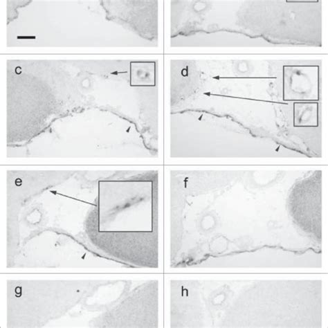 Time Dependent Expression Of Pgt Mrna In The Brain Subarachnoidal