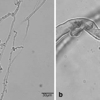 Light Microscopy Of The Hyphal Morphology Of Phytophthora Cinnamomi