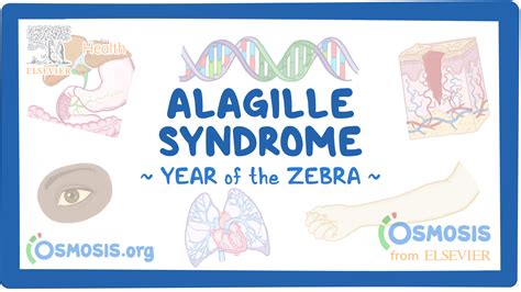 Alagille Syndrome Nord Video And Causes Osmosis