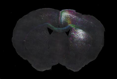 Mouse Brain Anatomy