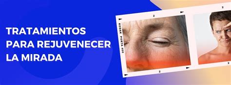 Rejuvenece Tu Mirada Con Estos Tratamientos De Bótox Para Los Ojos