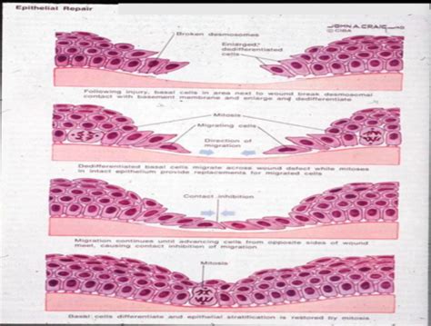 Stages of Wound Healing Flashcards | Quizlet