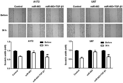 Microrna 663 Inhibits The Proliferation Migration And Invasion Of