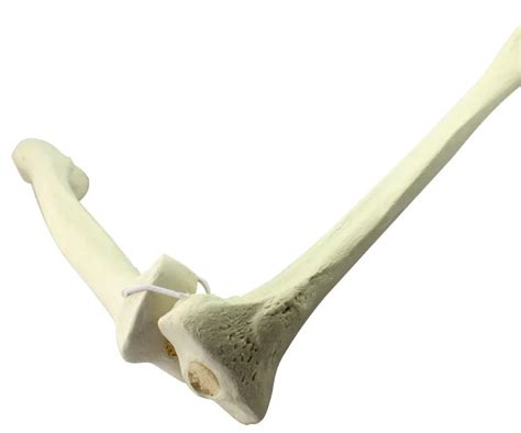 Human Tibia And Fibula Bone Model For Medical Learning And Training