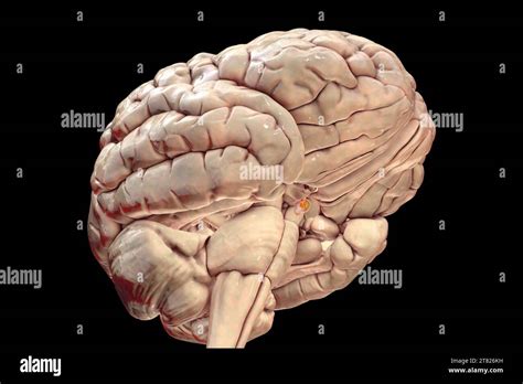 Pituitary Gland Tumour Illustration Stock Photo Alamy