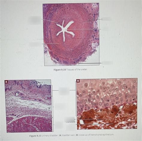 Histology Of Ureter Bladder Wall And Transitional Epithelium Diagram