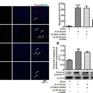 Dlx As Silencing Inhibited The Acute Injury Of Cerebral Neurons