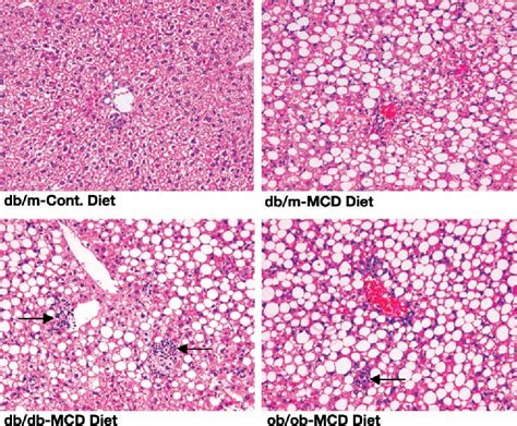 Figure 1 From Obese And Diabetic Dbdb Mice Develop Marked Liver Fibrosis In A Model Of