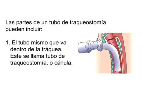 PatEdu Cuidados de la traqueostomía Pediatría