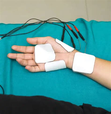 Carpal Tunnel Denville Medical