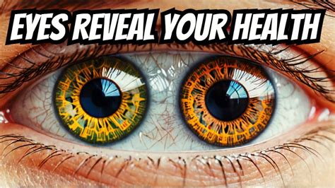 What Your Eyes Say About Your Health Youtube