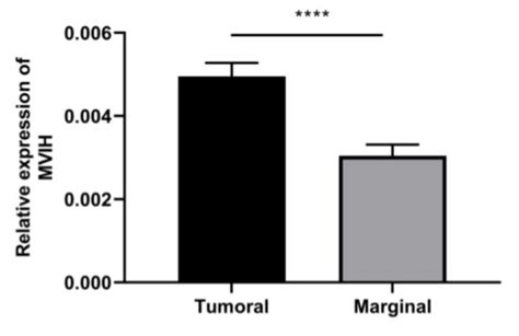 Ectopic Expression Of LncRNA MVIH As A Potential Diagnostic Biomarker