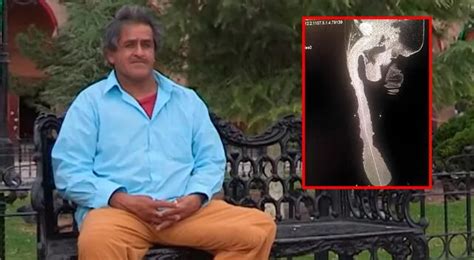 Qué fue de Roberto Esquivel el mexicano cuyo pene mide 48 cm y le