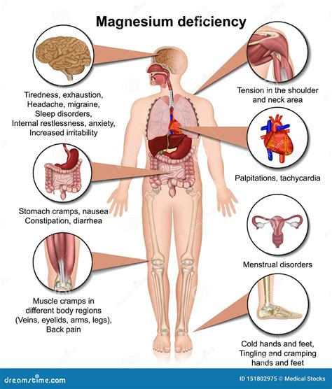 Magnesium Deficiency Stock Illustrations – 28 Magnesium Deficiency