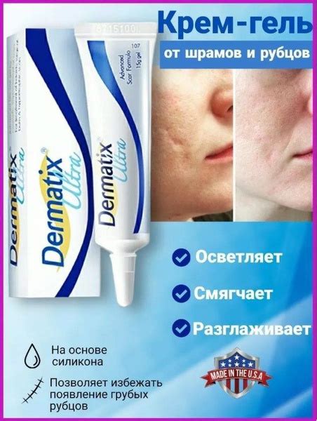 Вопросы и ответы о Dermatix Гель Крем для уменьшения выраженности и ...