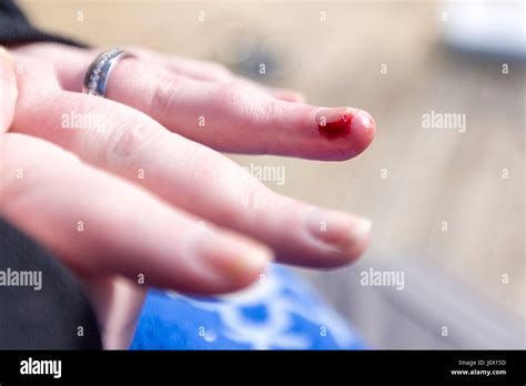 Hand Cut Blood Bleeding Hi Res Stock Photography And Images Alamy