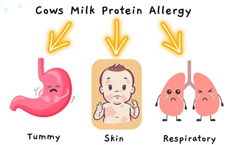 Symptoms Of CMPA Archives Bump2baby Nutrition