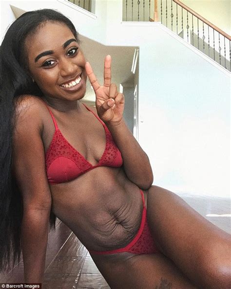 Texas Mother Shows Off Stretch Marks In Lingerie Shoot Daily Mail