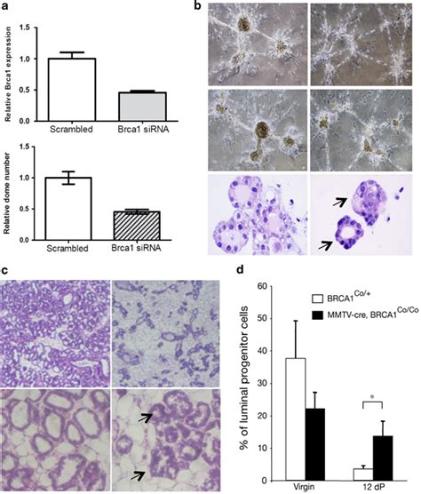 Suppression Of Brca Results In Defective Mammary Epithelial