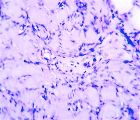 Photomicrograph Showing Compact Groups Of Spindle Shaped Cells With