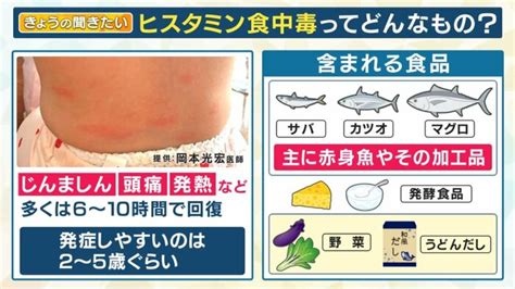 「ヒスタミン食中毒」保育園児40人以上発症 サバやマグロなど魚に多い加熱しても防げず 舌先にピリっと感じたら要注意【奈良発】｜fnnプライム